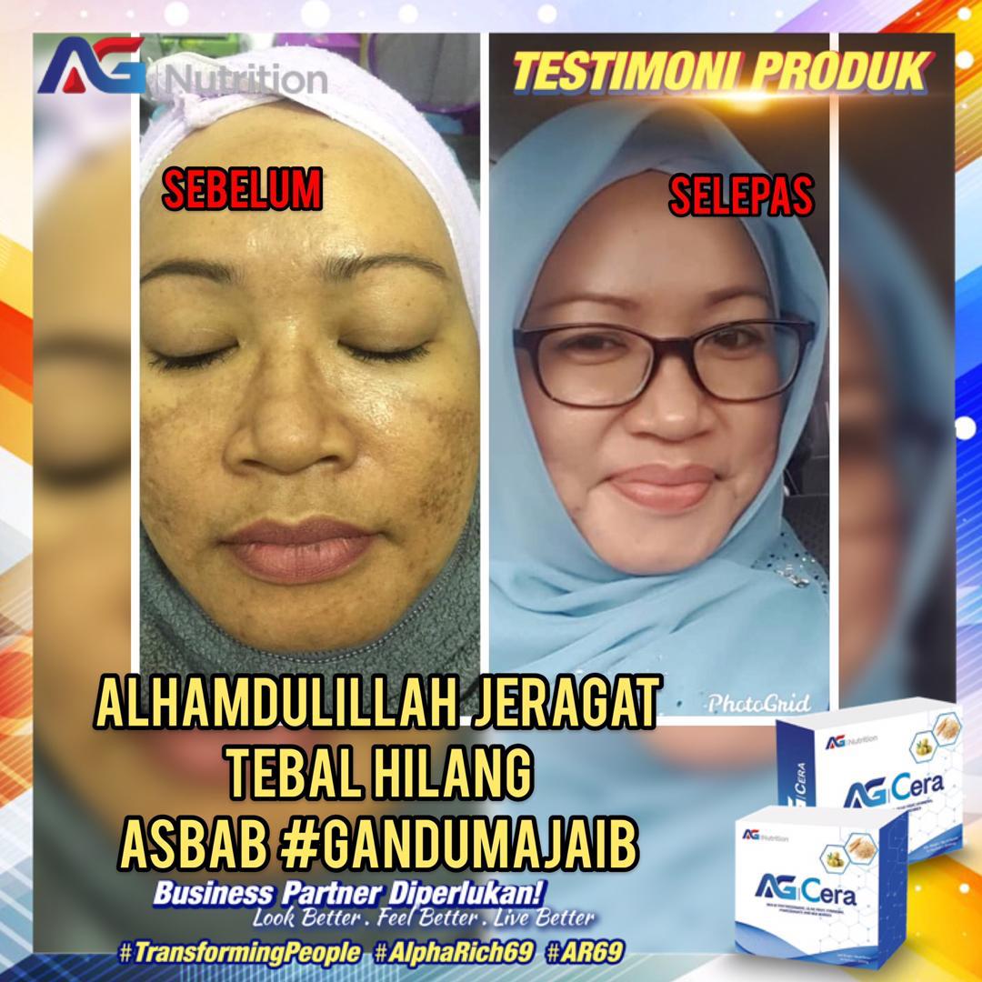 testimoni ag cera 2